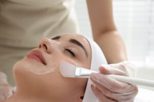 Med spa professional applying a chemical peel